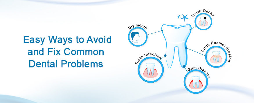 Common Dental Problems and How to Avoid Them